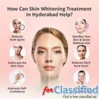 Skin Whitening Treatment in Hyderabad