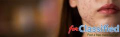 Acne Treatment in Greater Kailash