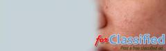 Open Pores Treatment in Greater Kailash