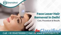 Affordable Face Laser Hair Removal in Delhi – Desmoderm