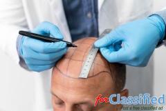 Affordable Hair Transplant in Allahabad – Only at Hair Aesthetica