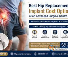 Best Hip Replacement Implant Cost Options at an Advanced Surgical Centre